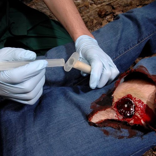 Аппликатор гемостатический с гранулами Rhino Rescue в Серпухове хитозановый